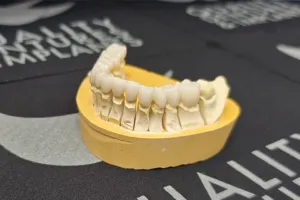 10000111421 10000111421