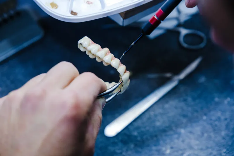 Adobestock 925327092 Copy Dental technician working on a denture