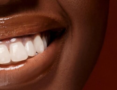 Choosing The Right Denture Solution: Factors To Consider in Baymeadows Jacksonville thumbnail